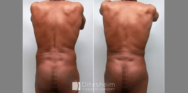 back (1)