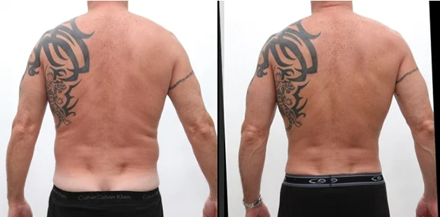 back (1)