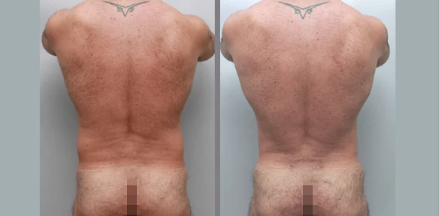 back (2)