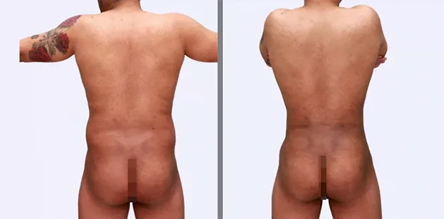 back