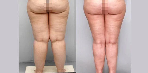 legs back 2