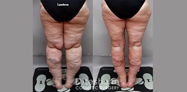 legs back2 (1)
