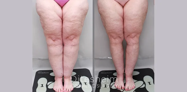 legs front (3)