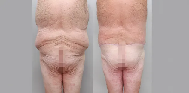 backguy2