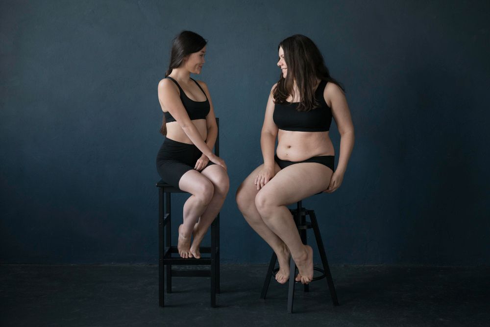 Woman with lipedema compared to obesity demonstrating disproportionate lower body fat