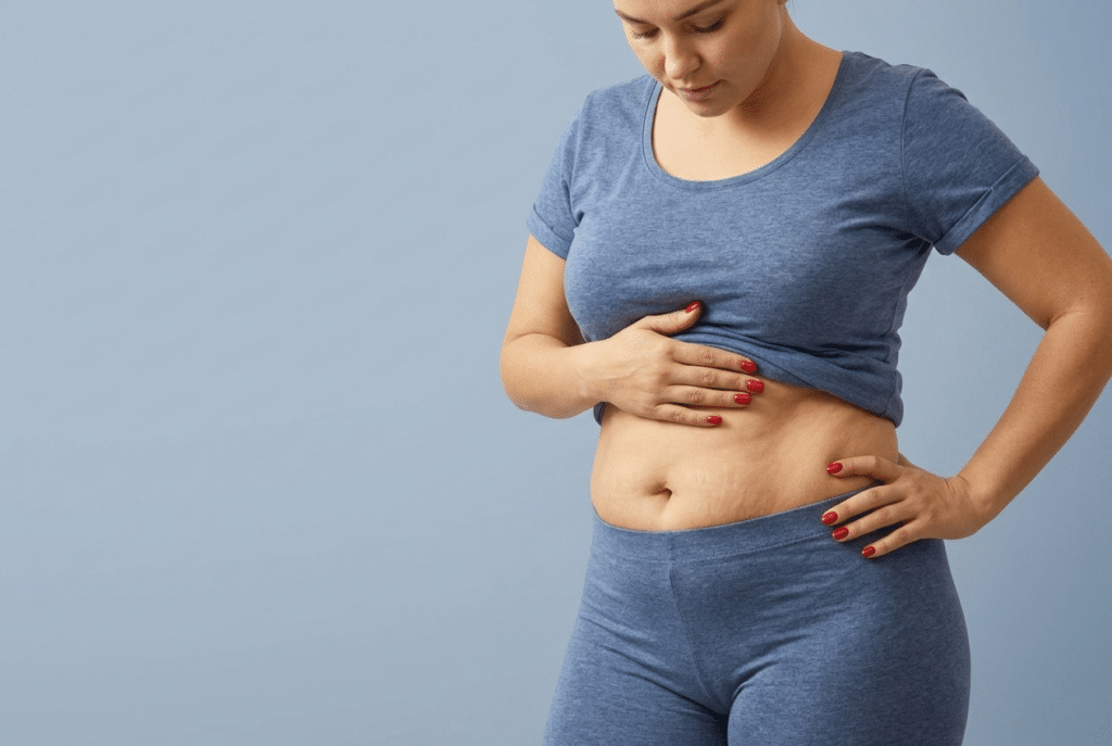 Tummy tuck with liposuction in Charlotte