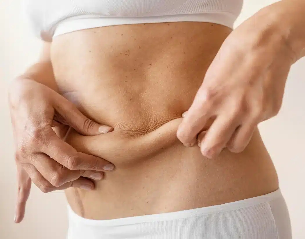 Tummy Tuck After Ozempic: When is the Right Time?