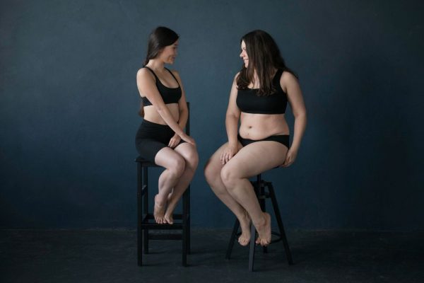 Woman with lipedema compared to obesity demonstrating disproportionate lower body fat