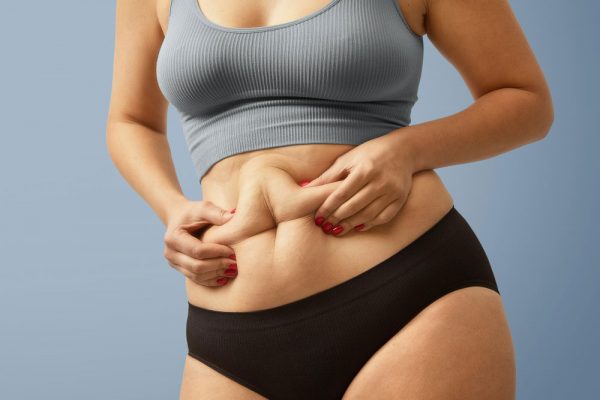 Female patient tummy tuck procedure for excess skin removal and tighter stomach
